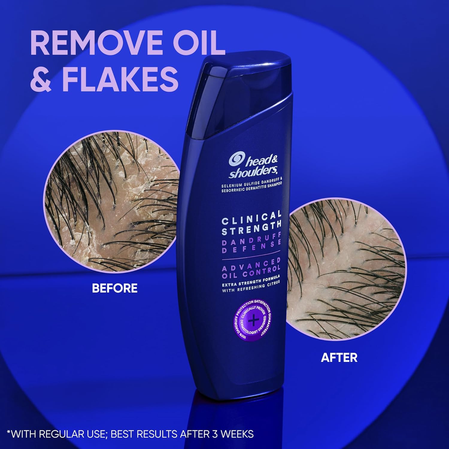 Head & Shoulders Clinical Dandruff Shampoo Twin Pack, Advanced Oil & Flake Control, Selenium Sulfide for Seborrheic Dermatitis Relief, Prescription Strength Scalp Care, Refreshing Citrus, 13.5 Oz Each