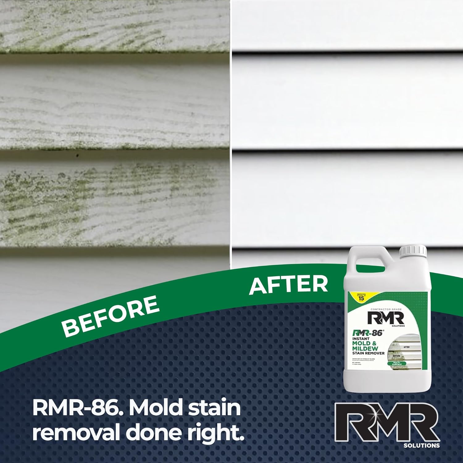RMR-86 Instant Mold and Mildew Stain Remover Spray - Scrub Free Formula, 32 Fl Oz